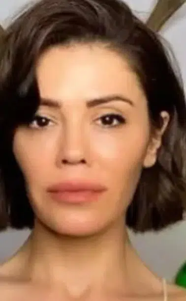 Didem Ceren Kimdir ve Güney Kore’de Yüz Nakli Mi Oldu?