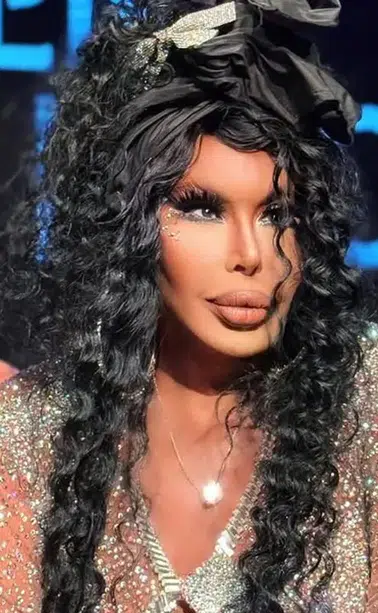 74 yaşındaki Bülent Ersoy yüz germe operasyonu geçirdi
