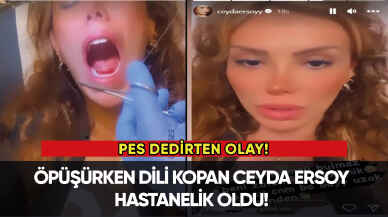 Öpüşürken dili kopan Ceyda Ersoy hastanelik oldu!