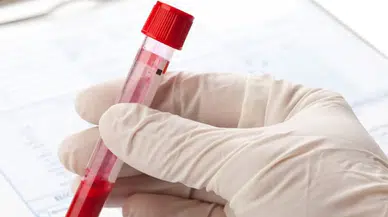 Kan testiyle kanser 10 yıl önceden belirlenebiliyor