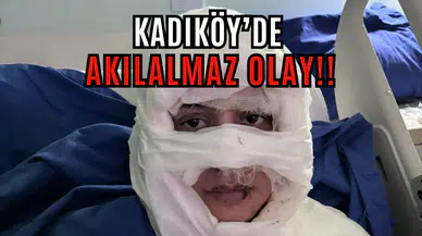 Genç bir kadın, başka bir kadın tarafından ateşe verildi!