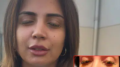 Esenyurt'ta güzellik merkezinde dehşet: Yapıştırıcı gözüne kaçtı!