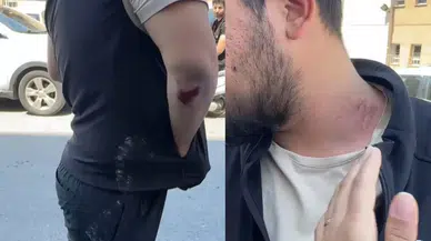 Güngören'de yaşanan patlama sonrası gazetecilere esnaftan saldırı!