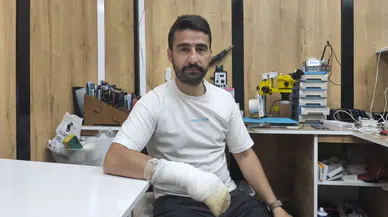 Bingöl'de cep telefonu bataryası patladı: O anlar kamerada!