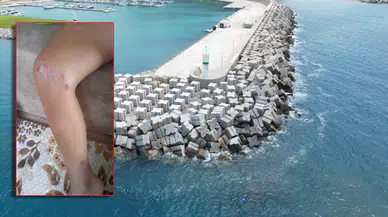 Küçük çocuk denize girdi, vücudunda yaralar çıktı! Gazipaşa’da endişe yaratan olay