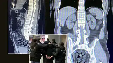 İranlı yolcu bağırsağında ve midesinde uyuşturucu ile yakalandı