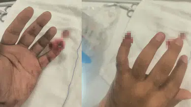 Uyuşturucu ile yakalandı: Polisin parmağını kopardı!