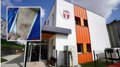 İBB kreşinde darp ve cinsel istismar skandalı! Mağdur çocuk anlattı: Çıplakken kameraya çekmişti