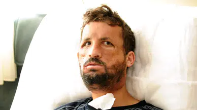 Türkiye’nin ilk yüz nakli Uğur Acar 14. yılında! 'Yüzünü aldığım kişinin yaşındayım'