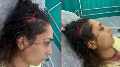 Adana’da bakkala giden kadın sokak köpeklerinin saldırısında yaralandı