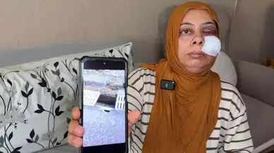 Elektrikli bisikletle kapağı kırık rögara düştü, yüzüne 14 dikiş atıldı