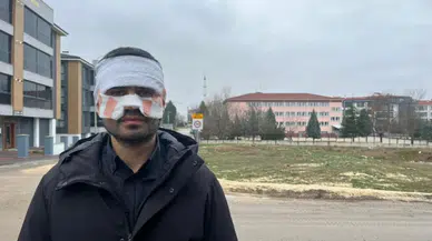 Eskişehir'de bir öğretmen, meslektaşının yüzüne kaynar çay döktü