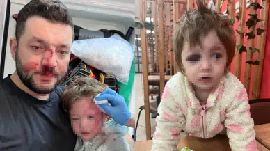 Yalova'daki kavgada darbedilen 14 aylık bebek taburcu edildi