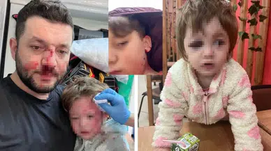 14 aylık bebeğe saldırmışlardı , şimdi de oğluna taş attılar