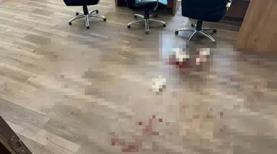 Yozgat'ta okul müdürünü darbeden veli tutuklandı