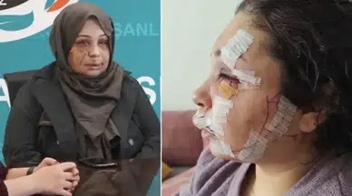 Boşanmak isteyen eşinin yüzünü tırnak makasıyla yaraladı !