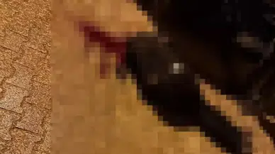 Şırnak Cizre’de sokakta yürürken tabanca ile başından vuruldu