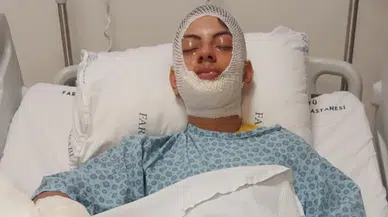 Trabzon'da bir genç ateşe benzin döktü, yaralandı