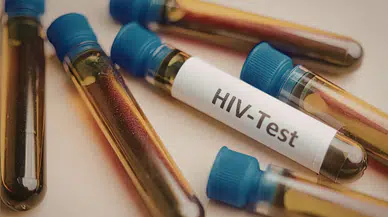 Türkiye'de HIV vakaları artışta : Uzmanlar ileri evre teşhisine karşı uyarıyor