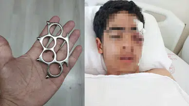 'Bana şaka yapma' dedi, hayatı karardı ! Esenyurt'ta 15 yaşındaki çocuğa muştalı saldırı