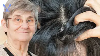 Saç diplerinde bitmek bilmeyen kaşıntıya kesin çözüm! Canan Karatay'dan gizli formül