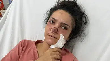 Manisa’da eşinin ısırarak kopardığı burnu ameliyatla dikildi