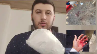 Sipariş almaya gitti, döner bıçaklı saldırıya uğradı