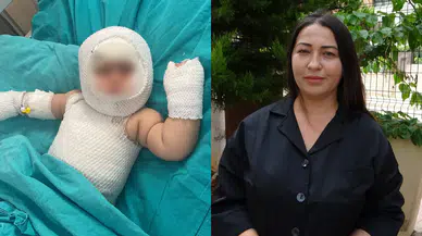 Patlayan domates konservesi 9 aylık bebeği yaraladı