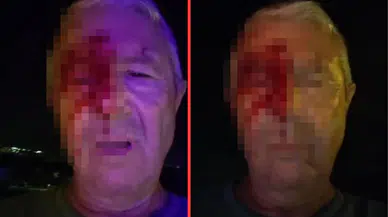 Kocaeli'de 2 kişinin saldırısına uğrayan muhabir kanlar içinde kaldı