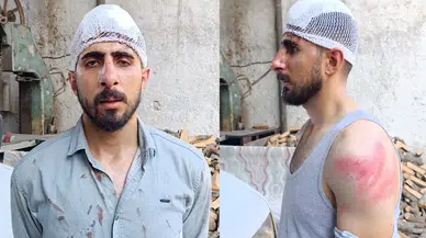Şanlıurfa'da 'yavaş gidiyorsun' tartışması : Sürünün burnu kırıldı, başına 8 dikiş atıldı