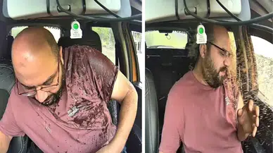 Artvin’de taksi şoförü ölümden döndü ! Kamyonun sıçrattığı çamurlu su taksinin içine girdi