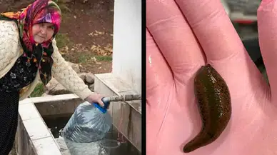 Çorum'da su içerken boğazına canlı sülük kaçan öğretmenin yaşadığı korkunç olay
