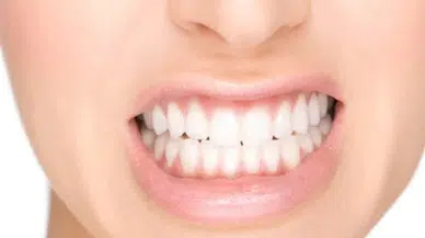 Dişlerinizi Sararmaktan Kurtaran Doğal Yöntemler Nelerdir?