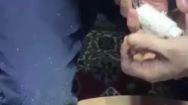 Küçük kızın parmağını boruya sıkıştırması sonrası itfaiye ekipleri müdahale etti