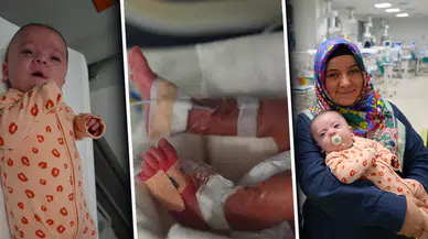 Samsun'da 720 Gram Doğan Bahar Bebek Hayata Tutundu