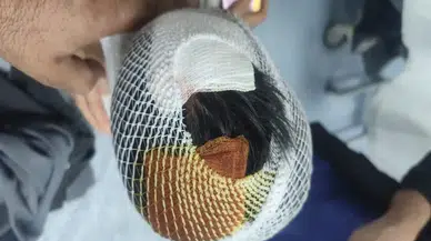 Şanlıurfa'da 8 yaşındaki çocuğa köpek saldırısı: 15 dikiş atıldı