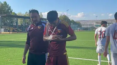 Kayserispor U19'da Hilmi Türkan Sakatlık Şoku Yaşadı