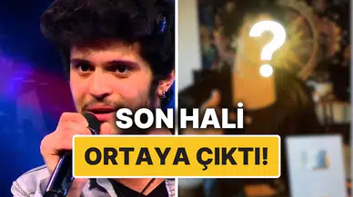 O Ses Türkiye Şampiyonu Emre Sertkaya'nın yeni imajı neden gündem oldu?