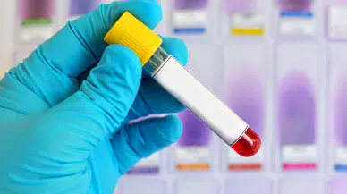 Alzheimer riskini öngören yeni bir kan testi yolda! Tam olarak ne zaman hazır olacak?