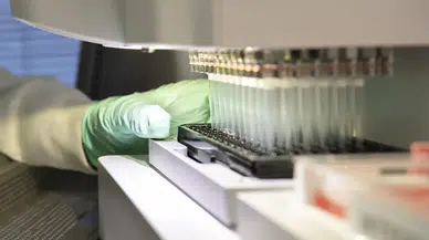 Yeni ultrason teknolojisi ile en agresif beyin tümörü nasıl canlı olarak izlenebilir ?