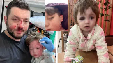 14 aylık bebeğe saldırmışlardı , şimdi de oğluna taş attılar