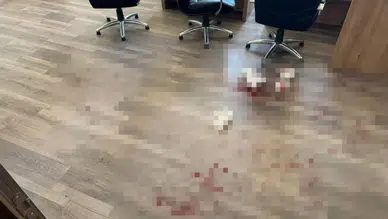 Yozgat'ta okul müdürünü darbeden veli tutuklandı