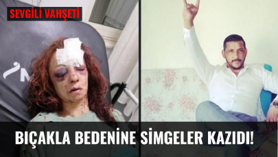 Sevgili vahşeti; Bıçakla bedenine simgeler kazıdı!