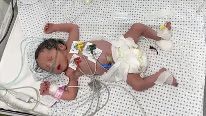 BM, Kuzey Gazze’deki yenidoğanların tahliyesini askıya aldı