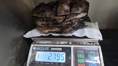 Sivas'ta bir hastanın göğüs kafesinden 3 kilogram tümör çıkarıldı!