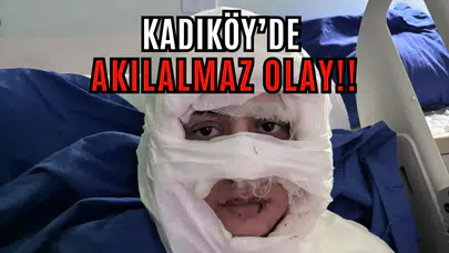 Genç bir kadın, başka bir kadın tarafından ateşe verildi!