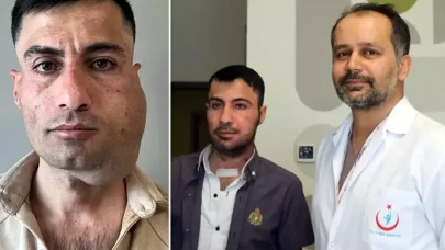 Çenesindeki tümör alındı, yerine bacağından parça nakledildi