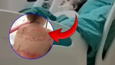 Montu alev alan öğrenci cayır cayır yandı!