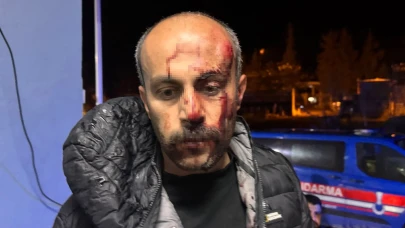 Şanlıurfa’da avukata darp iddiası! Soruşturma başlatıldı