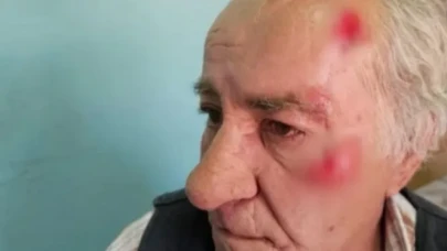 Köpeklerin saldırısına uğrayan yaşlı adam hastaneye kaldırıldı
